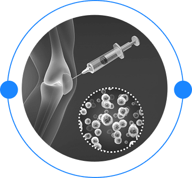 Platelet-Rich Plasma (PRP) Injection